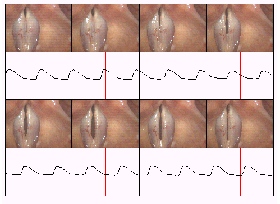 images showing vocal fold vibration