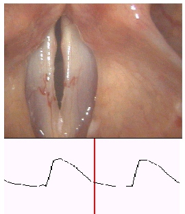 still from vocal fold vibration animation