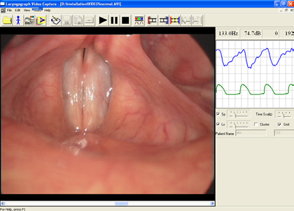 digital video image of the vocal folds