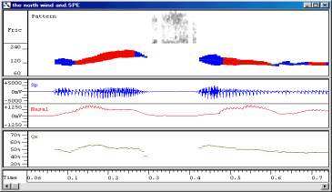 In the figure pattern, spech waveforms, nasality and Qx [contact phase] traces are shown.